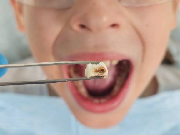 Best Root Canal Emergency Dentist  in Lonoke, AR